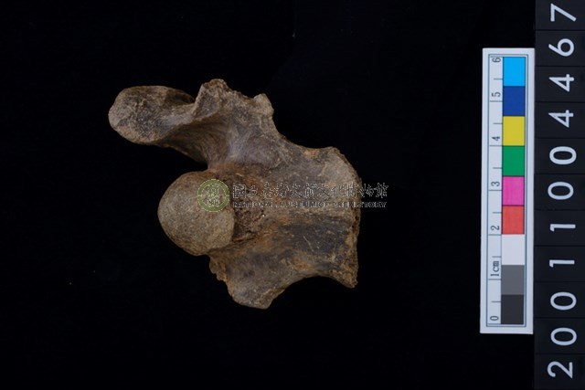 軸椎（頸椎第2節）