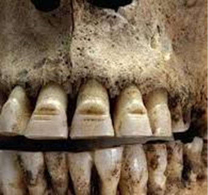 維京人的鑿齒（圖片出處)