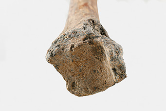 圖4、NKLE-F3B3脛骨末端之蹲距面。