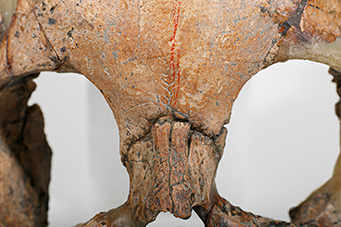 圖5、NKLE-F3B4可見鼻上縫（類似未癒合之額縫）。